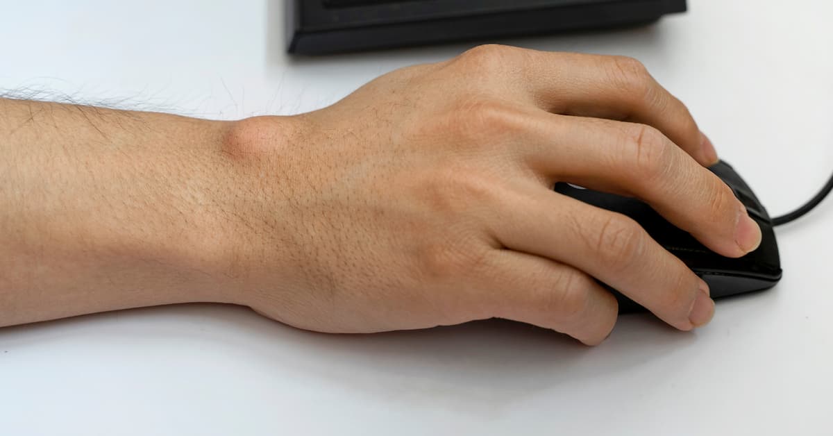 ganglion cyst diagnosis boise